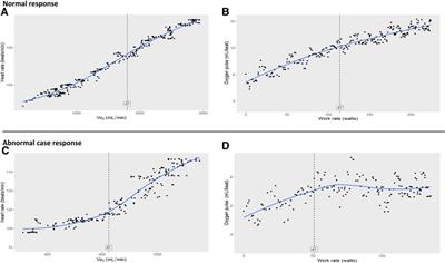 Case report: A proposed role for cardiopulmonary exercise testing in detecting cardiac dysfunction in asymptomatic at-risk adolescents